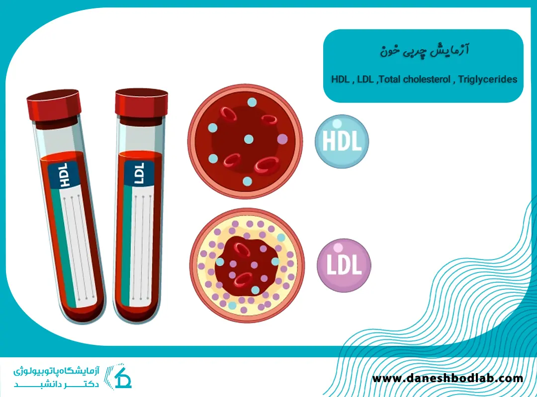 چربی خون بالا | از علائم تا تشخیص با آزمایش چربی خون