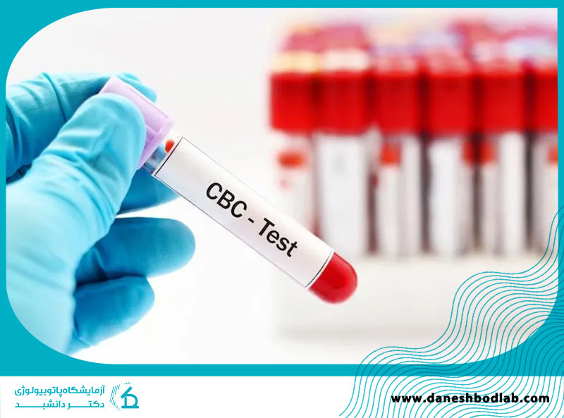 همه چیز درباره آزمایش خون CBC | راهنمای قدم به قدم برای بیماران