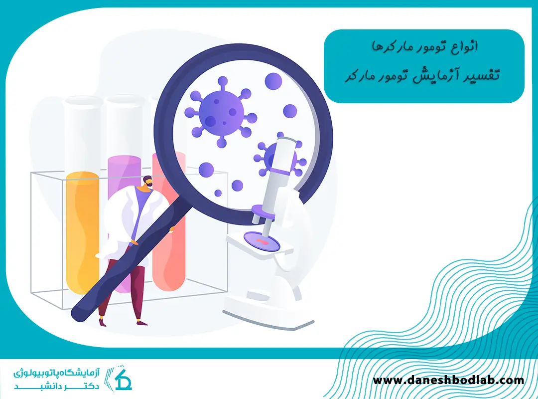 آزمایش تومور مارکر در شیراز | تفسیر، رنج نرمال در تشخیص سرطان