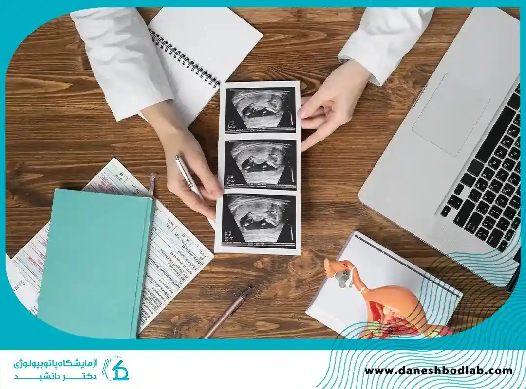 آزمایش غربالگری بارداری چیست؟ | زمان انجام، تفسیر نتایج و هزینه‌ها