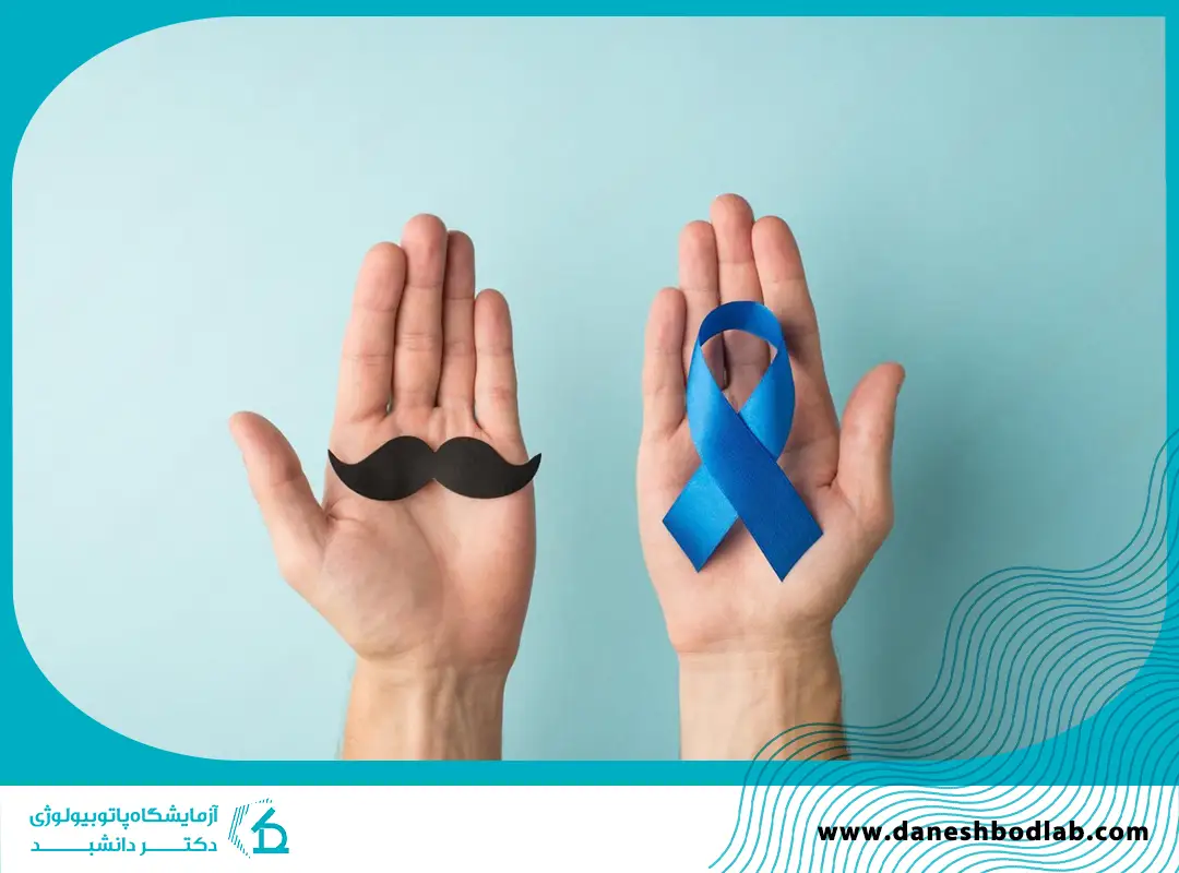 مراحل سرطان پروستات